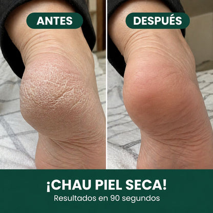 De esconder los pies a mostrarlos con confianza. En 90 segundos