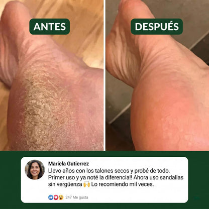 De esconder los pies a mostrarlos con confianza. En 90 segundos